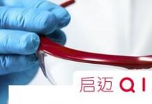 歐盟新護(hù)目鏡協(xié)調(diào)標(biāo)準(zhǔn)將于11月生效 啟邁QIMA解析新規(guī)要求